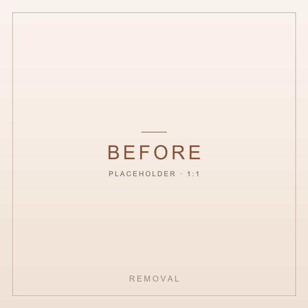Brow removal: the brow before the session